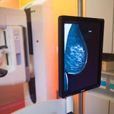 Onkologie: Bessere Therapie durch neue Daten